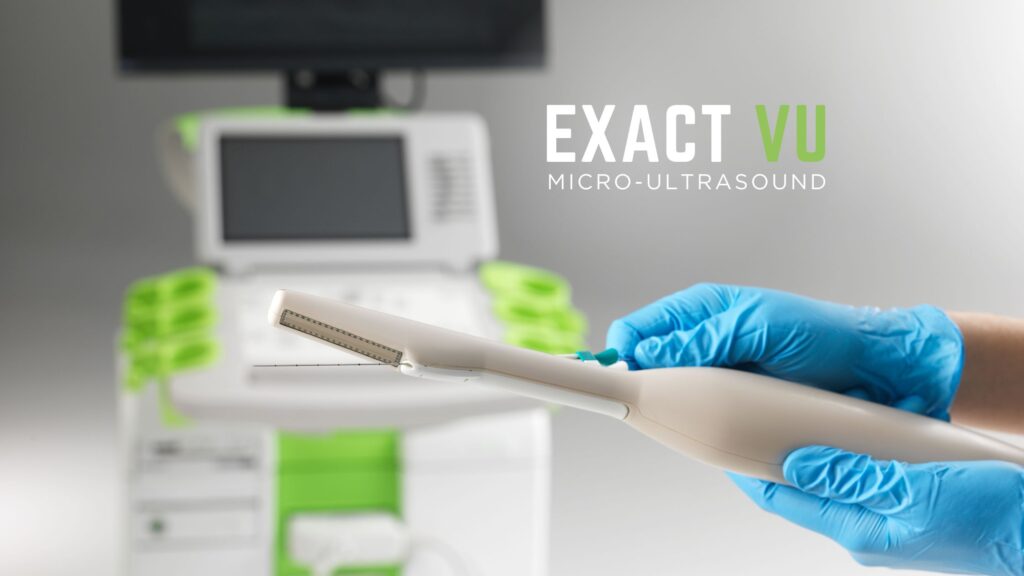 exactvu micro ultrasound