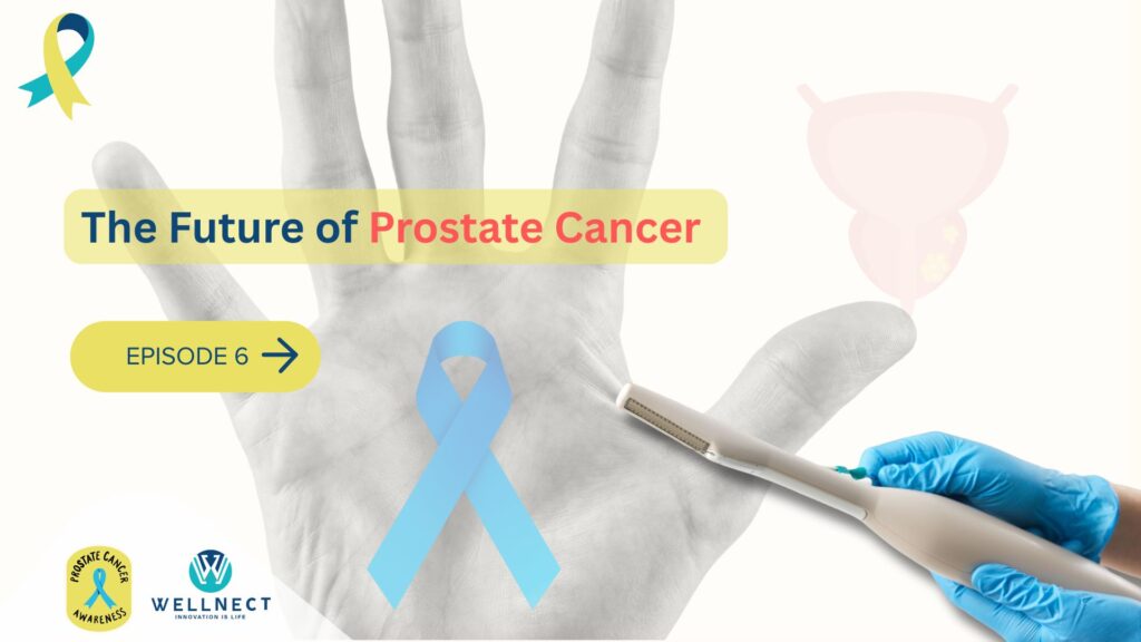micro ultrasound biopsy the future of prostate cancer diagnosis is here
