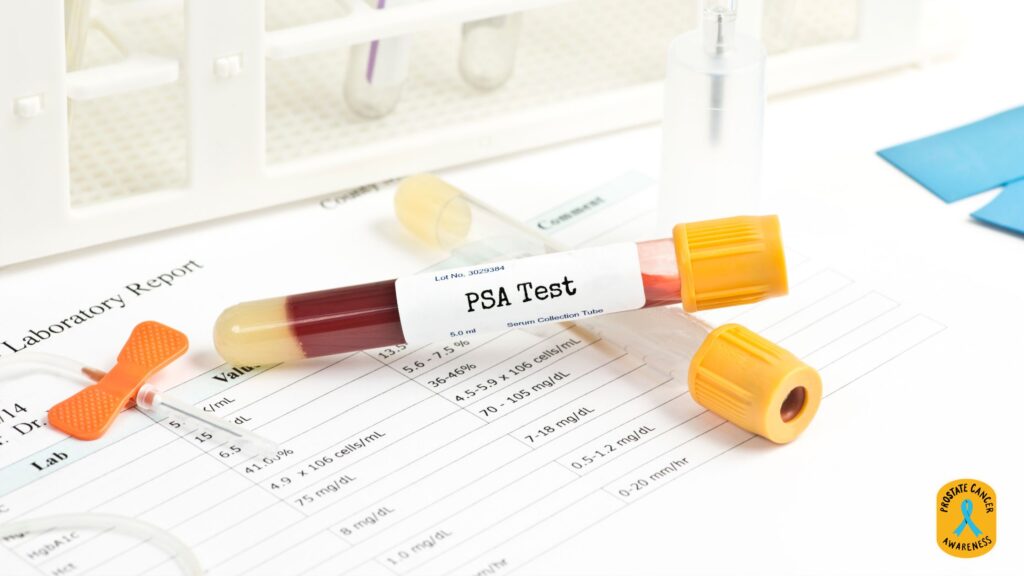 prostate specific antigen