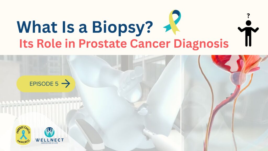 what is a biopsy understanding its role in prostate cancer diagnosis