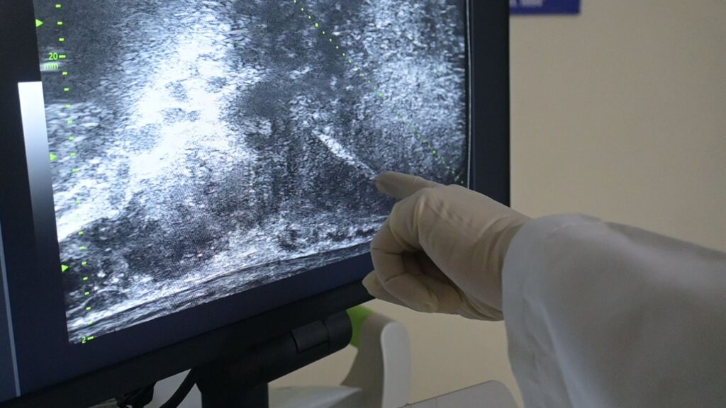 real time biopsy