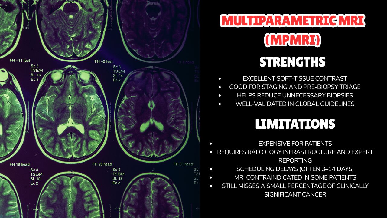multiparametric mri mpmri