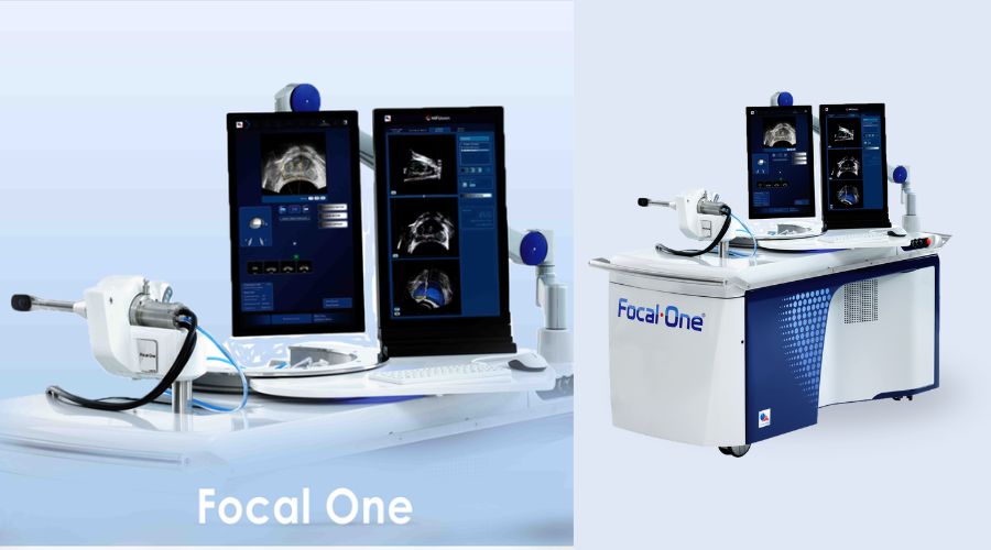 focal one robotic hifu